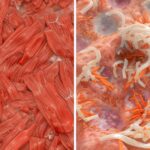 A comparison showing Sarcopenia, where healthy muscle is replaced by fat and shrinks with age.